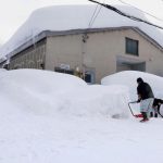 Ameliyata alınan hastadan 295 adet böbrek taşı çıkarıldı